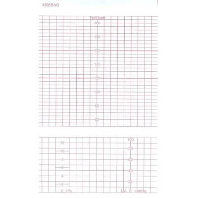 Лента тепл.регист. для CTG(FM) GE (COROMETRICS) BAO/DAO 151х90х150, K151Z90